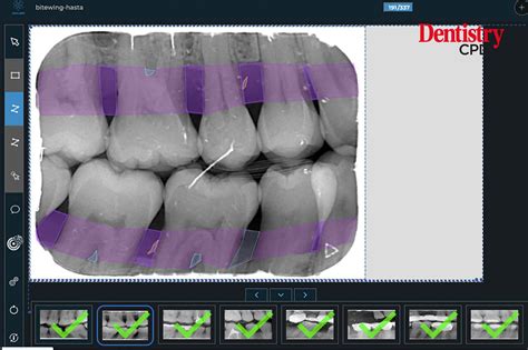 Periodontist Earning Potential