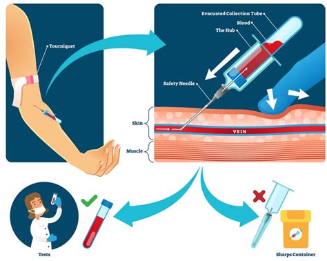 Phlebotomy Laboratory Procedures