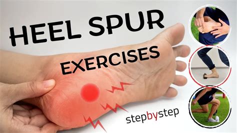 Physical Therapy for Heel Spurs