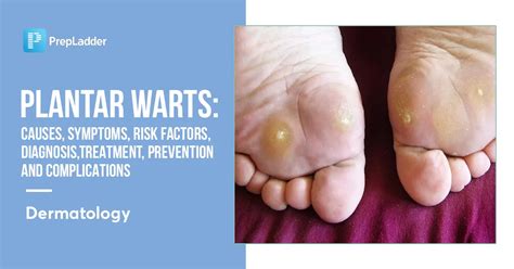 Plantar Wart Risks