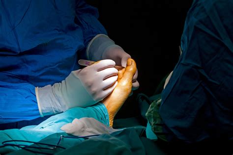 Podiatric Surgeon Performing Surgery