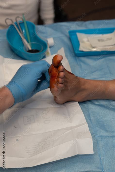 A podiatrist performing surgery