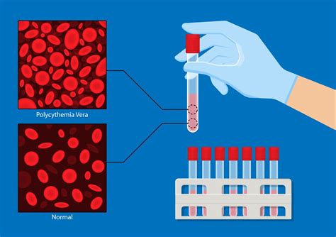 Policitemia research and future directions