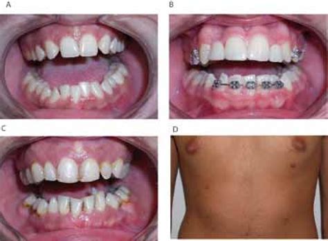 Description of Polythelia Awareness