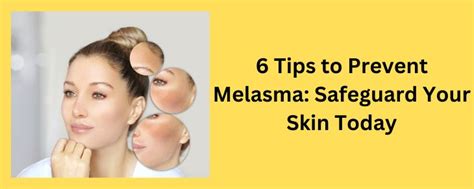 Preventing Melasma