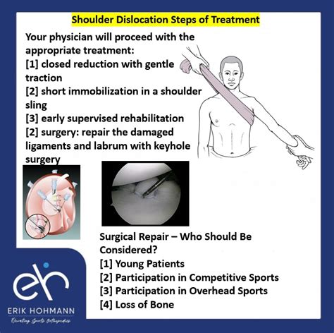 Prevention and Management of Subluxation