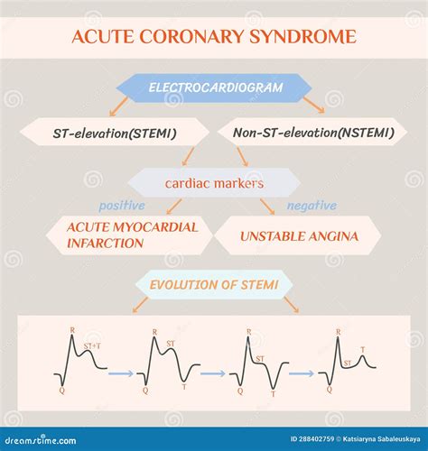 Prevention of ECG pattern