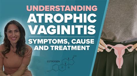 Prevention of Atrophic Vulvovaginitis