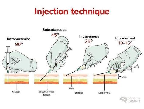 Proper Injection Technique