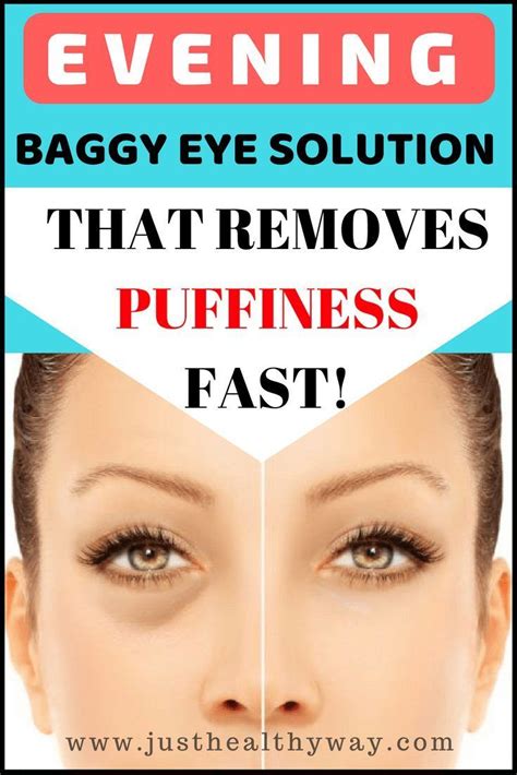 Puffy eyes solutions