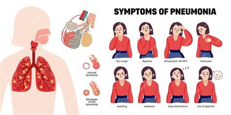 Symptoms of Pulmonía