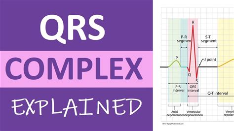 QRS complex EKG interpretation