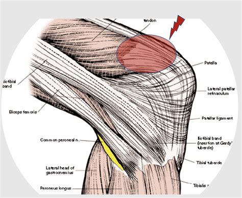 Quadriceps Tendon