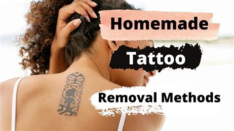 Qualified tattoo removal expert