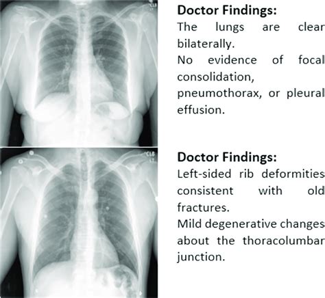 Practical Examples of Radiology