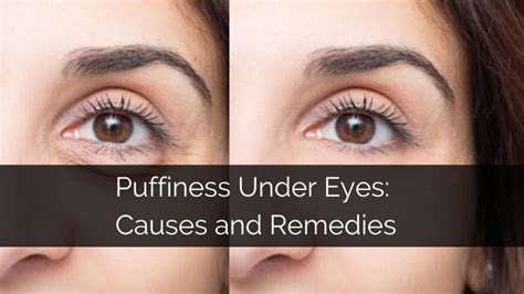 Reduce puffiness