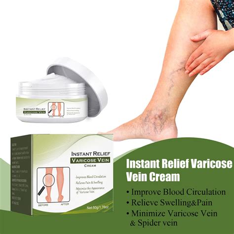 Relief from Varicose Veins