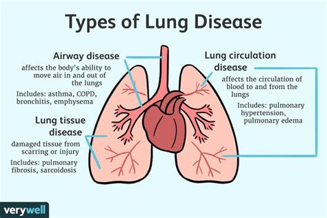 Respiratory conditions, such as asthma and chronic obstructive pulmonary disease (COPD), can disqualify individuals from military service