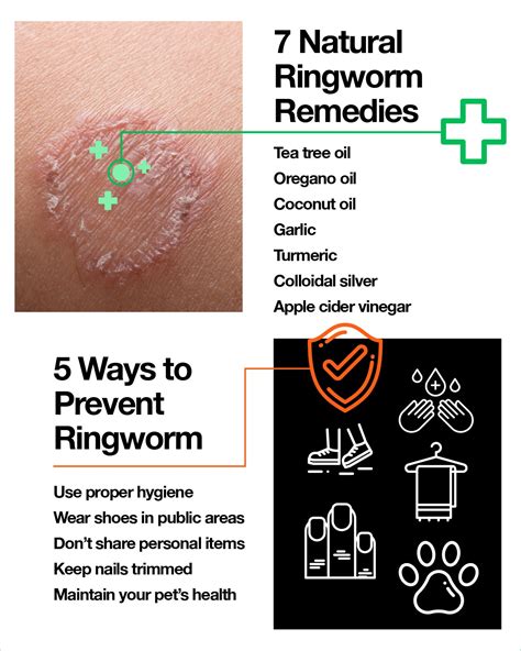 Ringworm causes