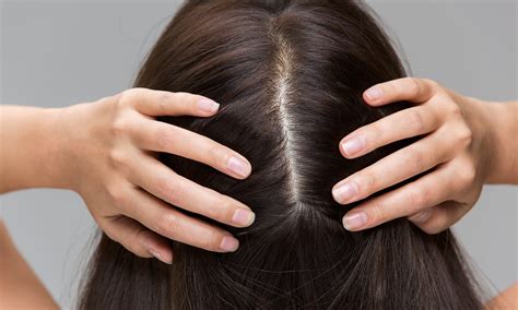 Importance of Scalp Health