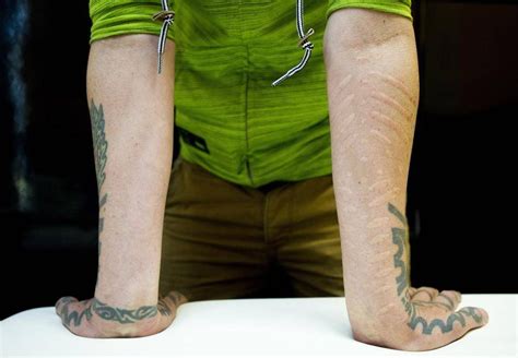 Scarification artists