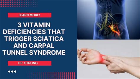 Sciatica Nerve Vitamin Deficiency