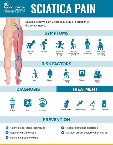 Sciatica Pain Prevention