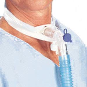 Securing the tracheostomy tube with a tie or strap