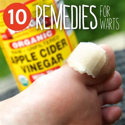 Seven Ways to Cure Warts