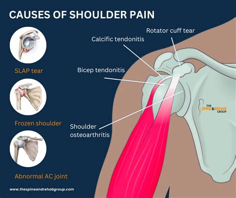 Additional tips and precautions for shoulder exercises