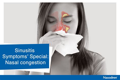 Description of Sinus Congestion