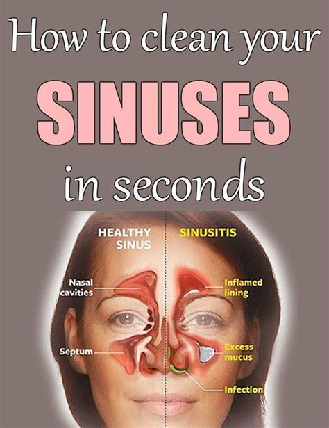 Sinus infection relief tips