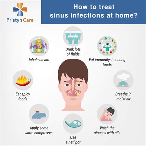 Sinusitis management