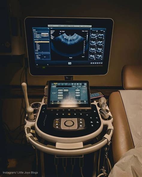 Sonographer operating ultrasound equipment