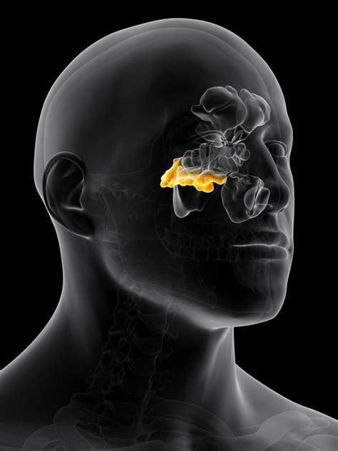 Sphenoid Sinus Infection Overview