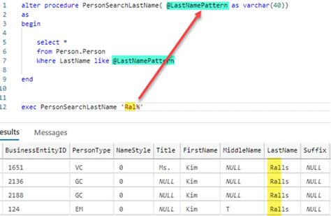 SQL Variable Tips