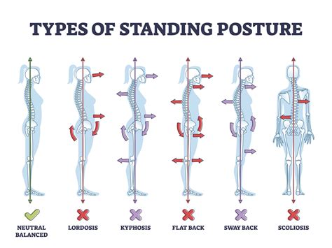 Standing Position