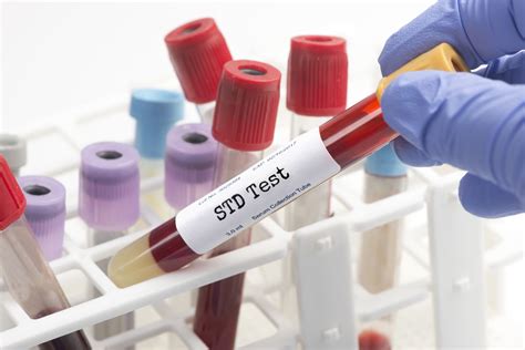 A laboratory technician working with test samples