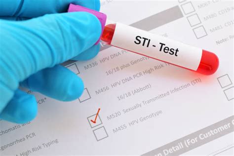 STD Testing Resources