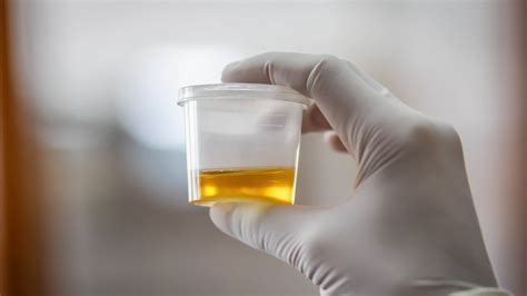 Storing Urine Specimen