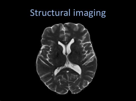 Structural Imaging Tests for Colon Cancer