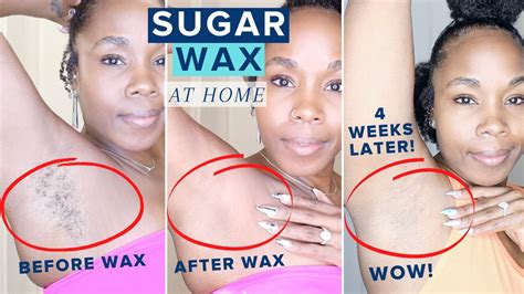 Aftercare for sugar waxing