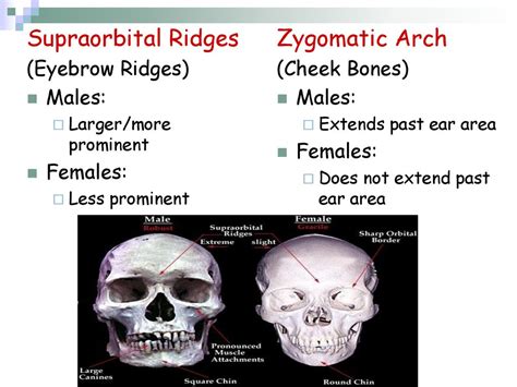 Supraorbital Ridge Anthropology