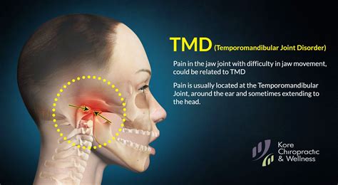 Surgery for Ear Jaw Pain