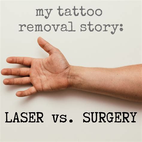 Surgical excision for tattoo removal