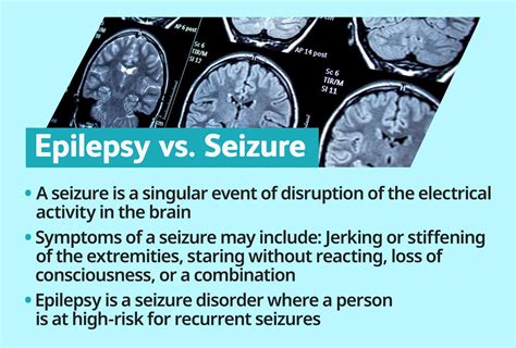 Syncope Seizure Disorder Explanation