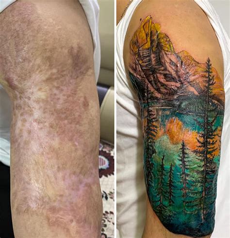 Tattoo artist scar cover up