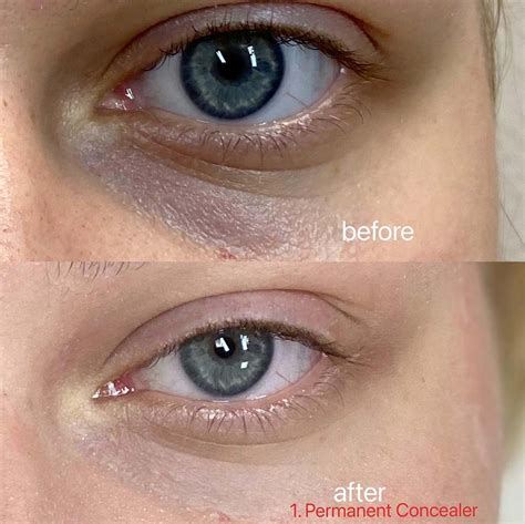 Tattoo concealer