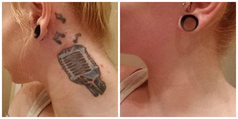 Tattoo cover makeup before and after