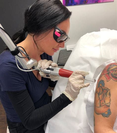 Tattoo removal clinics in Philadelphia